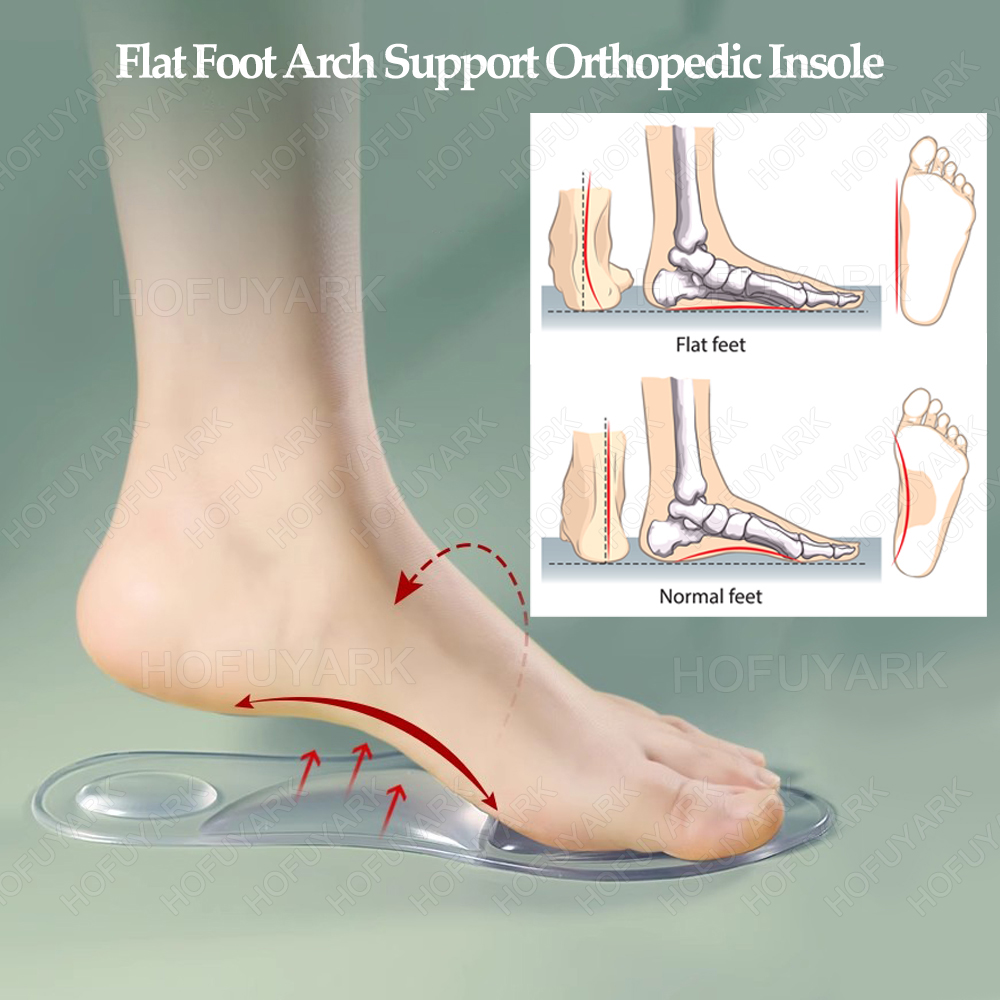 Silicone Gel Insoles Orthopedi - Women'S Shoes High Arch Support recensione e prezzo