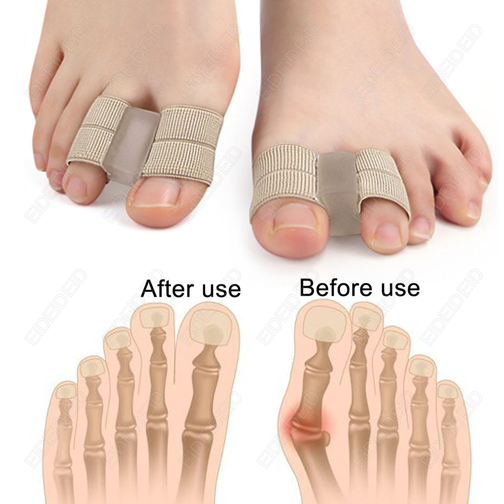 Bunion toe Corrector Orthotics - Women'S Shoes With Bunions recensione e prezzo